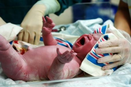 Emergency C-Sections
