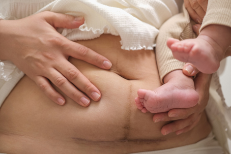 C-Section