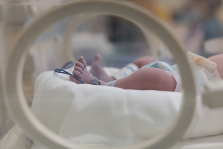 Early Signs of HIE